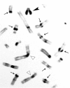 Figure 1. . C-banding of metaphase chromosomes.