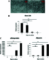 Figure 2. (A) Phase contrast microscopy representative images of hESC-derived hepatic endoderm morphology at day 9 of the differentiation observed in culture, at ×4 and ×10 magnification.