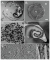 A six-panel microscopy of P. vortex cells and microcolonies