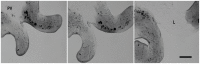 A photo showing transport of conidia by P. vortex