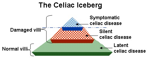 Figure 3. . The celiac iceberg represents all people who are genetically susceptible to celiac disease and have a positive celiac-associated antibody test result.