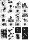Figure 1. Electron micrographs of retroviral particles.