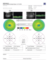 FIGURE. Stratus 1 – example thickness map (PDF file).