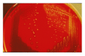 Figure 1. . Blood agar plate with typical colonies of a mucoid strain of group A streptococcus (left) and non-mucoid (glossy) colonies of an acapsular mutant (right).