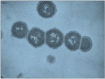 Figure 2. . Thin section electron micrograph of a chain of streptococci showing the surface M protein.