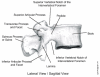 Figure 4. Lateral View of a Normal Lumbar Vertebra.