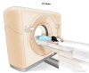 Computed tomography (CT) scan of the abdomen