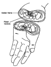 Figure 1. Location of the carpal tunnel.