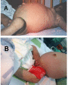 Figure 4. A and B.