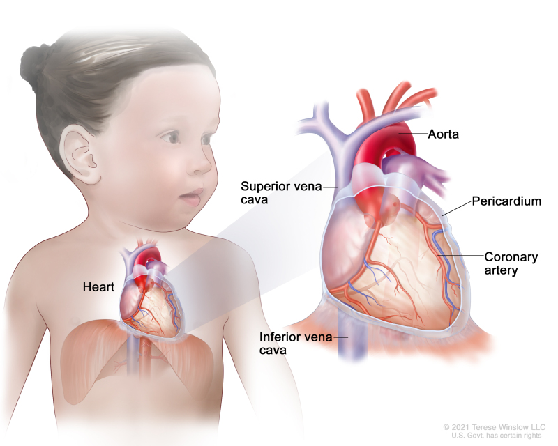 Anatomy of the heart; a pullout shows the aorta, superior vena cava, pericardium, coronary artery, and inferior vena cava.