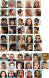 Figure 1. . Individuals with characteristic facial features of Wiedemann-Steiner syndrome; first 15 are shown in front and side views.