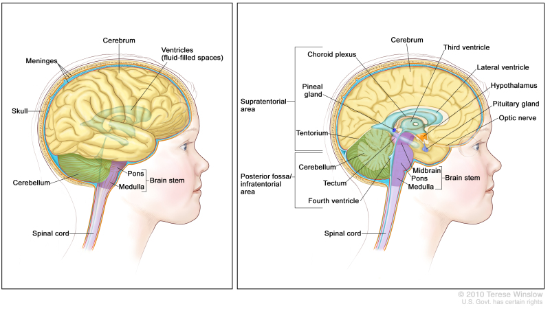 Anatomy of the brain; the right panel shows the supratentorial area (the upper part of the brain) and the posterior fossa/infratentorial area (the lower back part of the brain). The supratentorial area contains the cerebrum, lateral ventricle and third ventricle (with cerebrospinal fluid shown in blue), choroid plexus, pineal gland, hypothalamus, pituitary gland, and optic nerve. The posterior fossa/infratentorial area contains the cerebellum, tectum, fourth ventricle, and brain stem (midbrain, pons, and medulla). The tentorium and spinal cord are also shown. The left panel shows the cerebrum, ventricles (fluid-filled spaces), meninges, skull, cerebellum, brain stem (pons and medulla), and spinal cord.