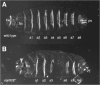 Figure 1. The late larval cuticle from a wild type larva is patterned by the segmentation process and contains a series of denticle belts characteristic for each segment (a1 to a8) A) In embryos mutant for the stat92E transcription factor (B), the fourth and fifth abdominal segments are lost (or fused) and the eighth is reduced.