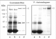 Figure 6. Phosphorylation of the rod cGMP-gated channel β-subunit by protein kinase(s) in the ROS soluble fraction.