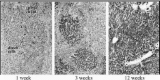 Figure 1. Massive repopulation of the liver by preparative irradiation.