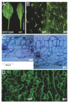 Figure 1. Morphological phenotypes of the angustifolia (an) mutant of arabidopsis.