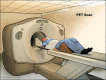 PET (positron emission tomography) scan