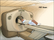 Positron emission tomography (PET) scan