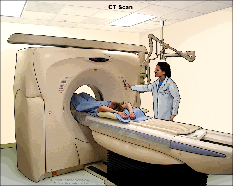 Computed tomography (CT) scan of the abdomen; drawing shows the patient on a table that slides through the CT machine, which takes x-ray pictures of the inside of the body.