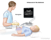 Abdominal ultrasound