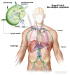 Stage III adult non-Hodgkin lymphoma