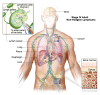 Stage IV adult non-Hodgkin lymphoma