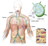 Anatomy of the lymph system, showing the lymph vessels and lymph organs including lymph nodes, tonsils, thymus, spleen, and bone marrow