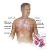 Anatomy of the respiratory system showing the trachea, the right and left lungs and their lobes, and the bronchi