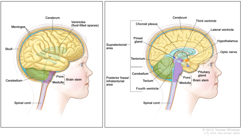 Anatomy of the brain; the right panel shows the supratentorial area (the upper part of the brain) and the posterior fossa/infratentorial area (the lower back part of the brain). The supratentorial area contains the cerebrum, lateral ventricle, third ventricle, choroid plexus, hypothalamus, pineal gland, pituitary gland, and optic nerve. The posterior fossa/infratentorial area contains the cerebellum, tectum, fourth ventricle, and brain stem (pons and medulla). The tentorium and spinal cord are also shown. The left panel shows the cerebrum, ventricles (fluid-filled spaces), meninges, skull, cerebellum, brain stem (pons and medulla) and spinal cord.