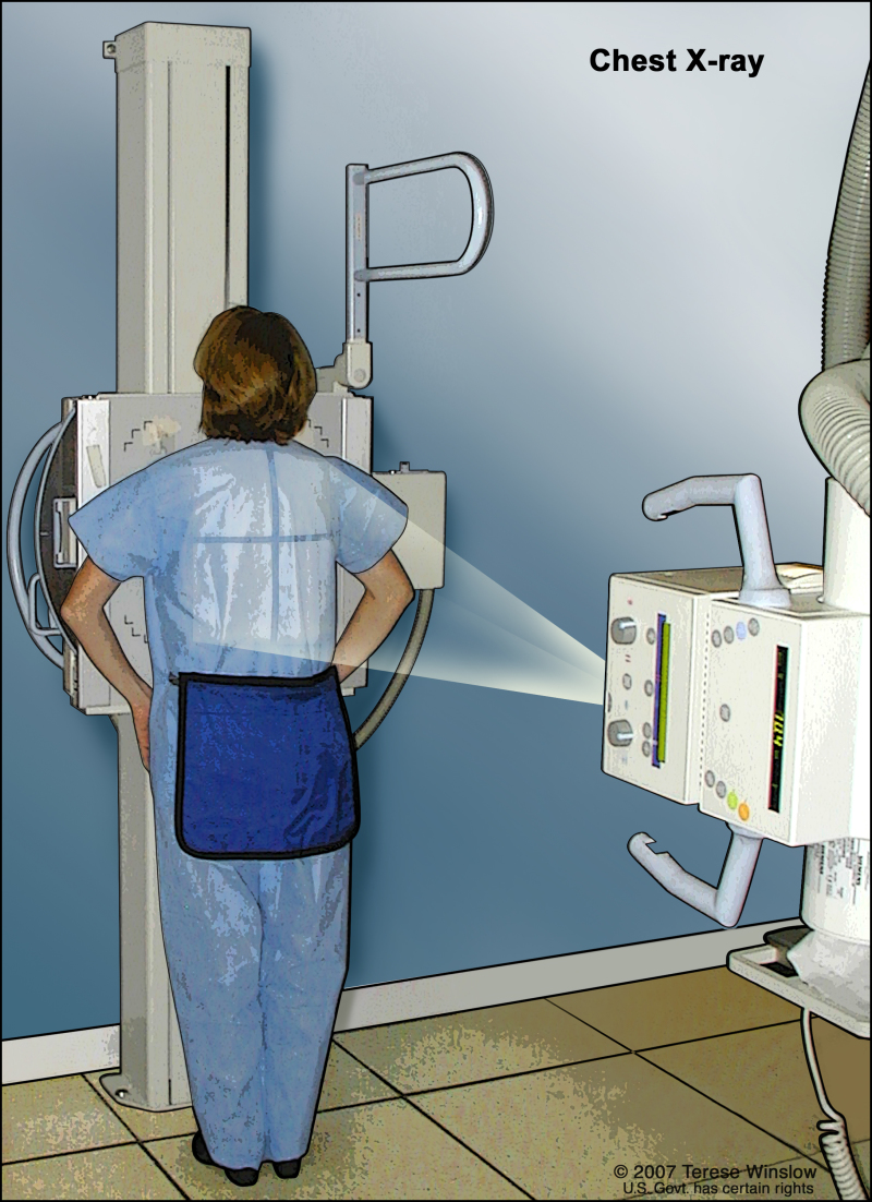 Chest x-ray; drawing shows the patient standing with her back to the x-ray machine. X-rays are used to take pictures of organs and bones of the chest. X-rays pass through the patient onto film.