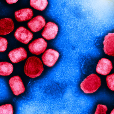 Colorized transmission electron micrograph of mpox virus particles (red) cultivated and purified from cell culture. Image captured at the NIAID Integrated Research Facility (IRF) in Fort Detrick, Maryland. Credit: NIAID]